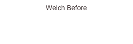 Welch Before